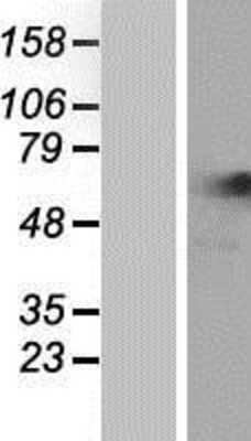 Western Blot: NARS Overexpression Lysate [NBP2-07864]