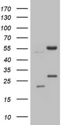 Western Blot: NARS2 Antibody (OTI10C10) [NBP2-46099]