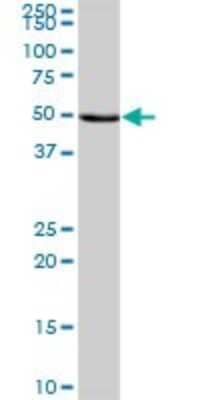 Western Blot: NARS2 Antibody [H00079731-B01P]