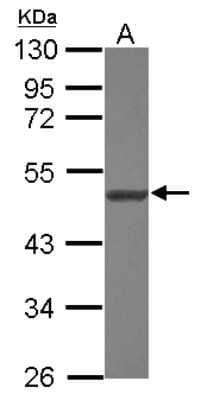 Western Blot: NARS2 Antibody [NBP2-19480]