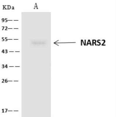 Western Blot: NARS2 Antibody [NBP3-06406]