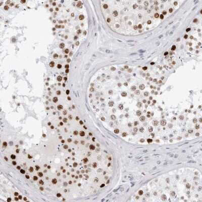 Immunohistochemistry-Paraffin: NASP Antibody [NBP2-33910]
