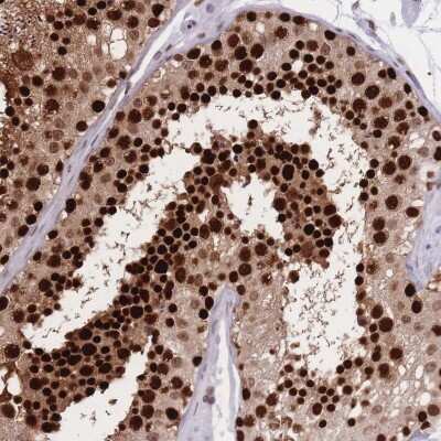 Immunohistochemistry-Paraffin: NASP Antibody [NBP2-33929]