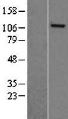 Western Blot: NASP Overexpression Lysate [NBL1-13483]