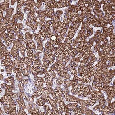 Immunohistochemistry-Paraffin: NAT1 Antibody [NBP2-13641]