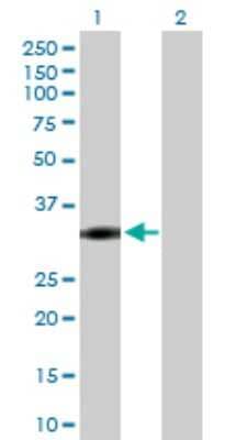 Western Blot: NAT1 Antibody [H00000009-D01P]