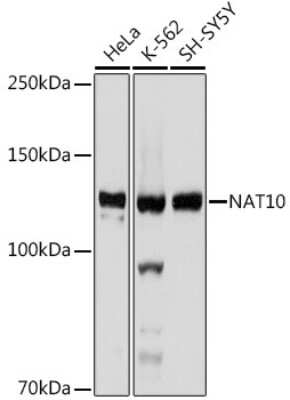 Western Blot: NAT10 Antibody (5Z3E5) [NBP3-15742]