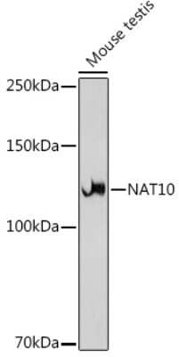 Western Blot: NAT10 Antibody (5Z3E5) [NBP3-15742]