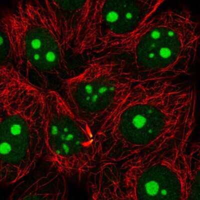 Immunocytochemistry/ Immunofluorescence: NAT10 Antibody [NBP2-56861]