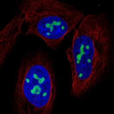 Immunocytochemistry/ Immunofluorescence: NAT10 Antibody [NBP2-57390]