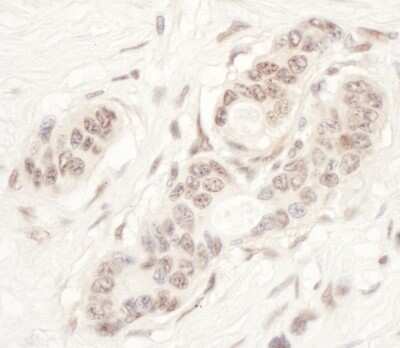 Immunohistochemistry: NAT10 Antibody [NBP2-32263]