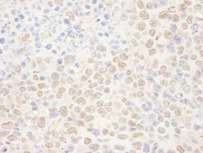 Immunohistochemistry: NAT10 Antibody [NBP2-32263]