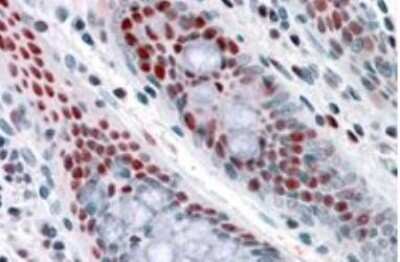 Immunohistochemistry-Paraffin: NAT10 Antibody [NBP1-06055]