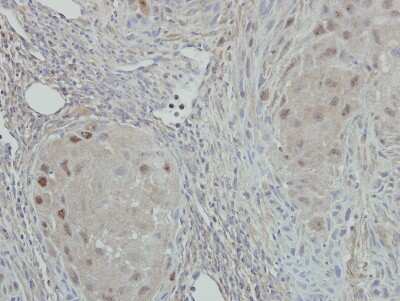 Immunohistochemistry-Paraffin: NAT10 Antibody [NBP2-15034]