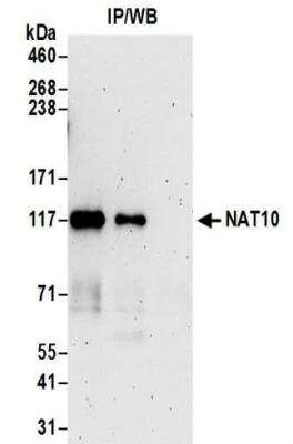 Immunoprecipitation: NAT10 Antibody [NBP2-32263]