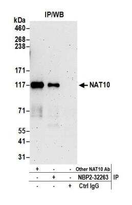 Immunoprecipitation: NAT10 Antibody [NBP2-32263]