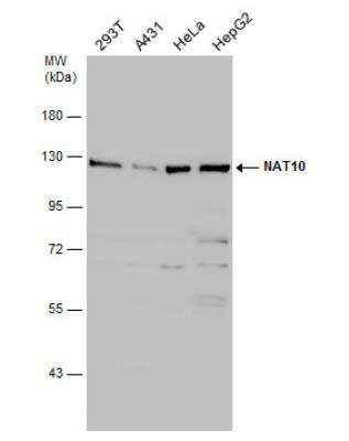 Western Blot: NAT10 Antibody [NBP2-15033]