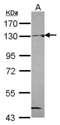 Western Blot: NAT10 Antibody [NBP2-15034]