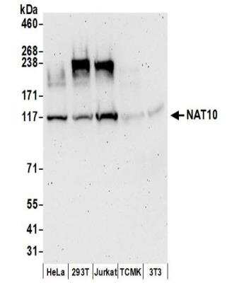 Western Blot: NAT10 Antibody [NBP2-32263]