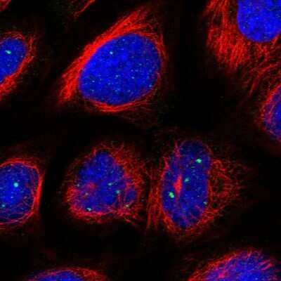 Immunocytochemistry/ Immunofluorescence: NAT11 Antibody [NBP1-92168]