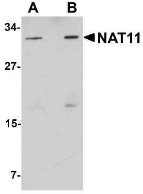 Western Blot: NAT11 AntibodyBSA Free [NBP1-77095]