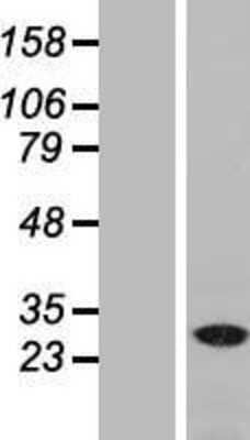 Western Blot: NAT11 Overexpression Lysate [NBL1-13486]