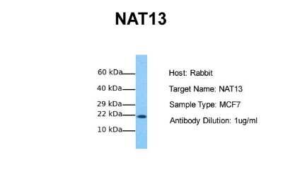 Western Blot: NAT13 Antibody [NBP1-55172]