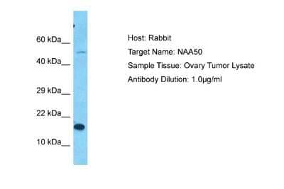 Western Blot: NAT13 Antibody [NBP2-86724]