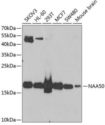 Western Blot: NAT13 AntibodyBSA Free [NBP2-93076]