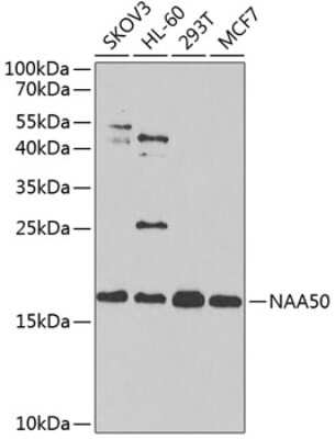 Western Blot: NAT13 AntibodyBSA Free [NBP2-93356]