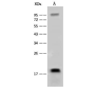 Western Blot: NAT13 Antibody [NBP2-99510]