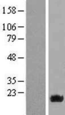 Western Blot: NAT13 Overexpression Lysate [NBL1-13487]