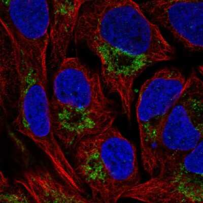 Immunocytochemistry/ Immunofluorescence: NAT14 Antibody [NBP2-55519]