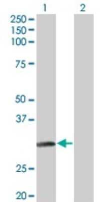 Western Blot: NAT2 Antibody (3B5) [H00000010-M01]