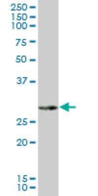 Western Blot: NAT2 Antibody [H00000010-B01P]
