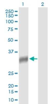 Western Blot: NAT2 Antibody [H00000010-B01P]