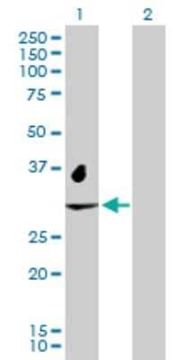 Western Blot: NAT2 Antibody [H00000010-D01P]