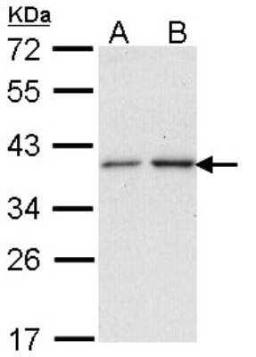 Western Blot: NAT2 Antibody [NBP1-33751]