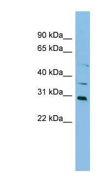 Western Blot: NAT2 Antibody [NBP1-59526]