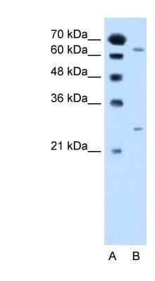 Western Blot: NAT2 Antibody [NBP1-59905]