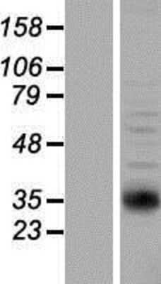 Western Blot: NAT2 Overexpression Lysate [NBP2-09064]