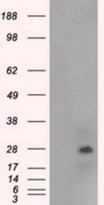 Western Blot: NAT8 Antibody (OTI5A8) [NBP1-47863]