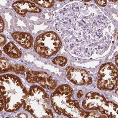 Immunohistochemistry-Paraffin: NAT8 Antibody [NBP2-62657]