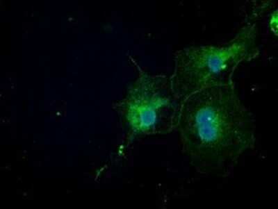Immunocytochemistry/ Immunofluorescence: NAT8 Antibody (OTI5A8) - Azide and BSA Free [NBP2-72878]