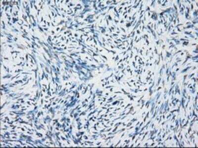 Immunohistochemistry: NAT8 Antibody (OTI5A8) - Azide and BSA Free [NBP2-72878]