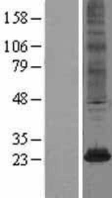 Western Blot: NAT8 Overexpression Lysate [NBL1-13491]