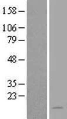 Western Blot: NAT8L Overexpression Lysate [NBL1-13493]