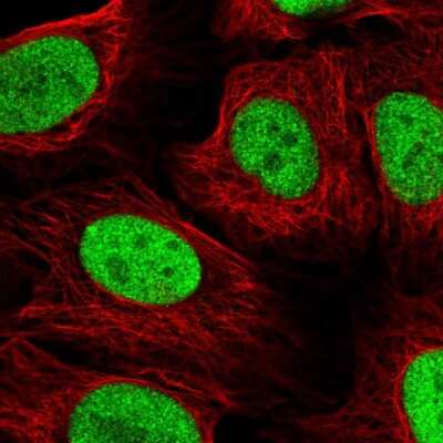 Immunocytochemistry/ Immunofluorescence: NAT9 Antibody [NBP2-58039]