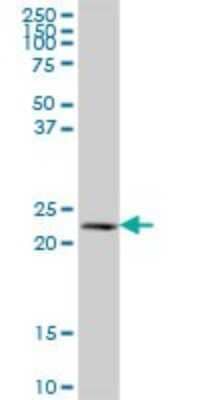 Western Blot: NAT9 Antibody [H00026151-B01P]