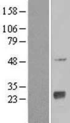 Western Blot: NAT9 Overexpression Lysate [NBL1-13494]